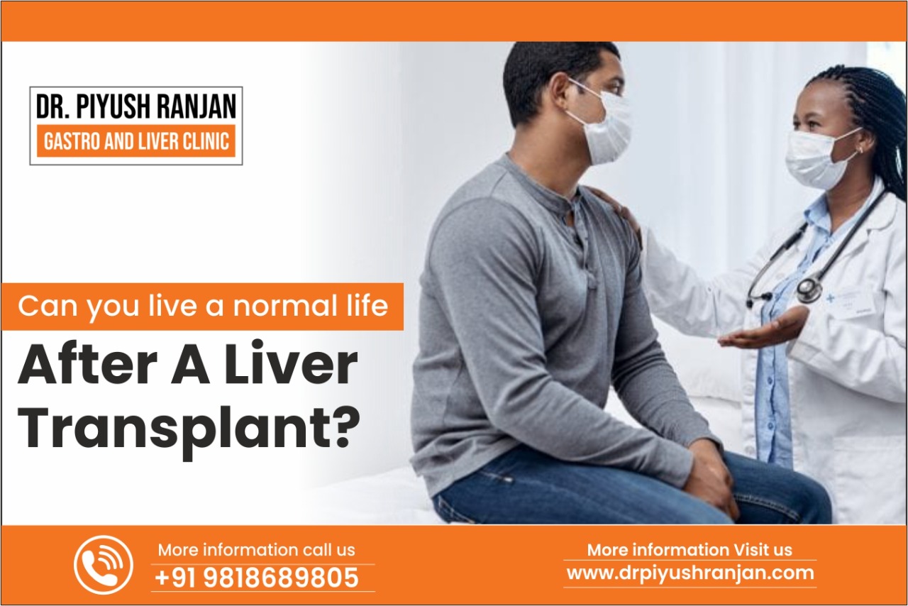 Read more about the article Can You Live a Normal Life After a Liver Transplant?