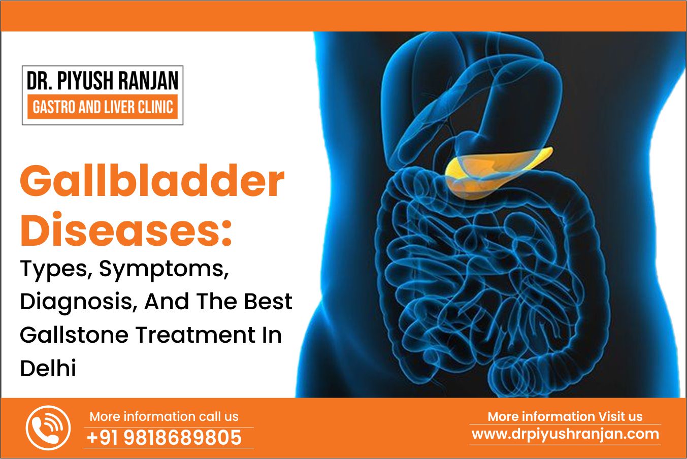 Read more about the article What Is the best gallstone treatment? – Dr. Piyush Ranjan