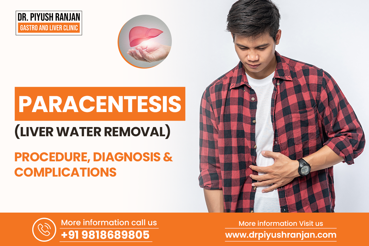 Read more about the article Liver Water Removal (Paracentesis )- Procedure, Diagnosis & Complications